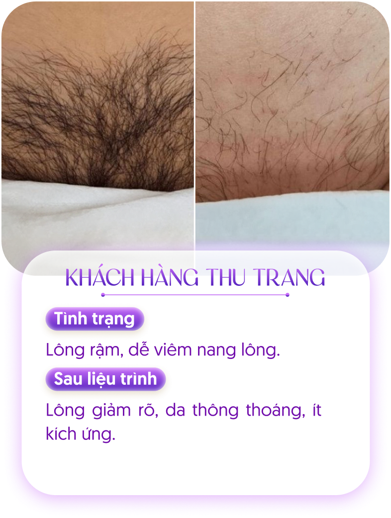 Kết quả khách hàng 3