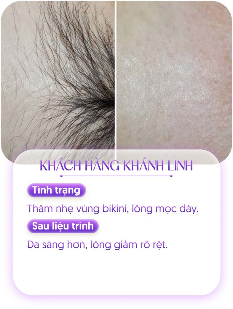 Kết quả khách hàng 2
