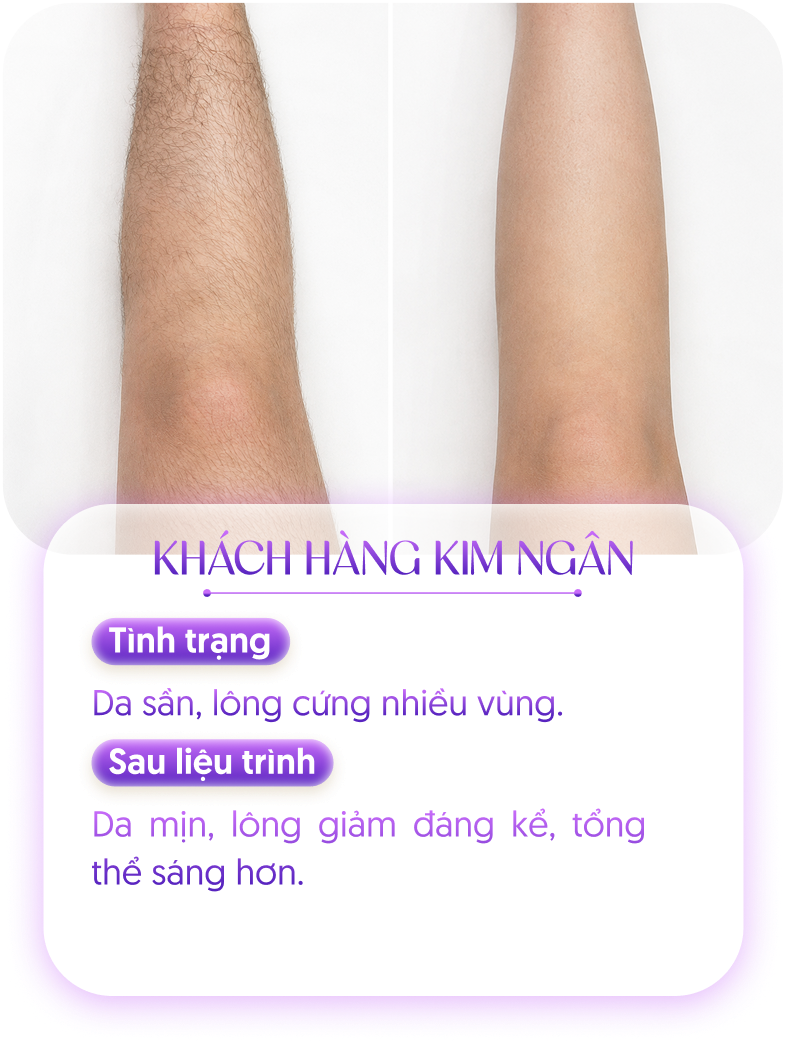 Kết quả khách hàng 3