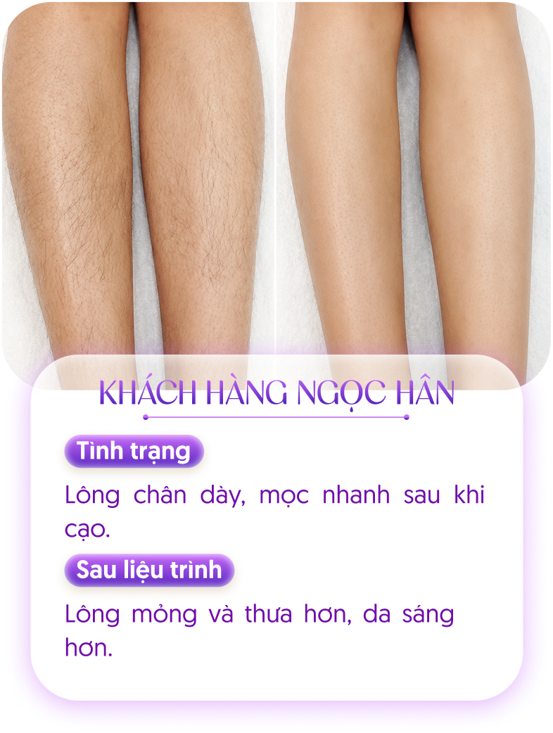Kết quả khách hàng 1