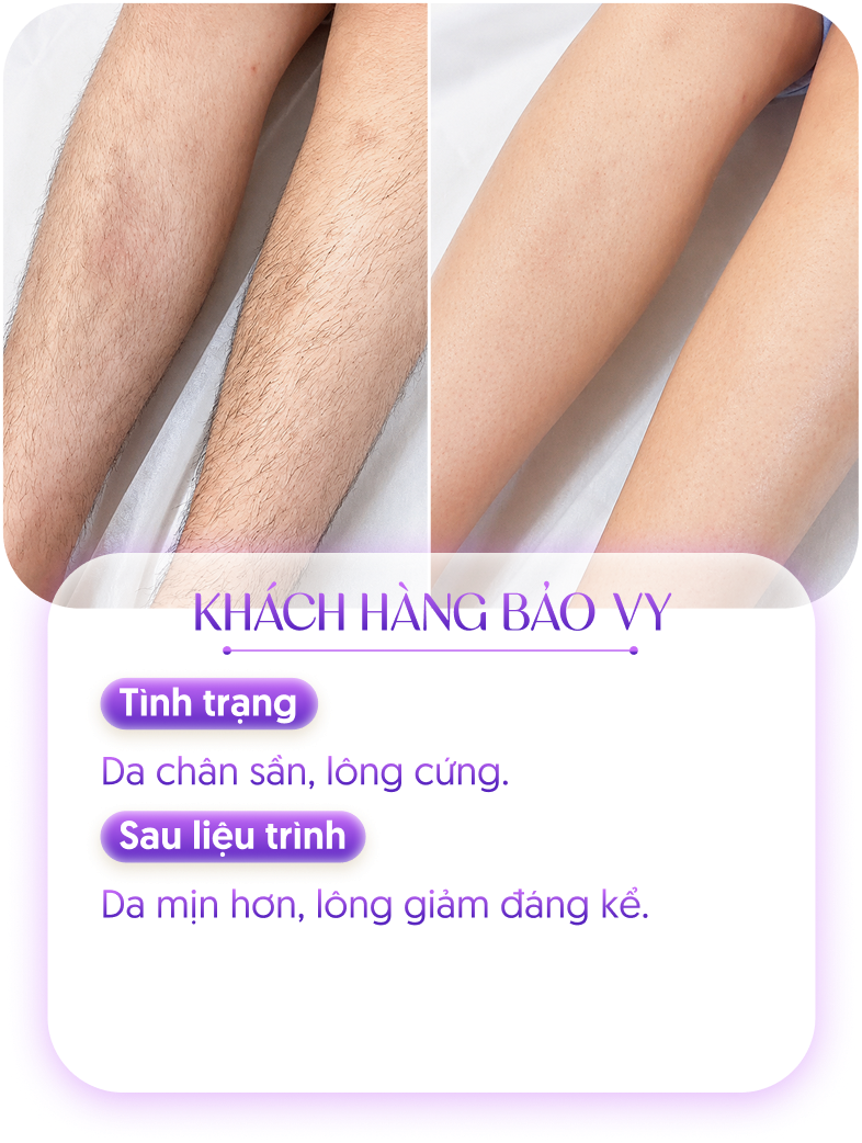 Kết quả khách hàng 2
