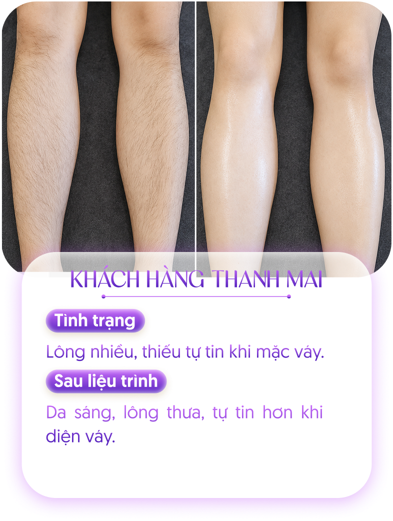 Kết quả khách hàng 3