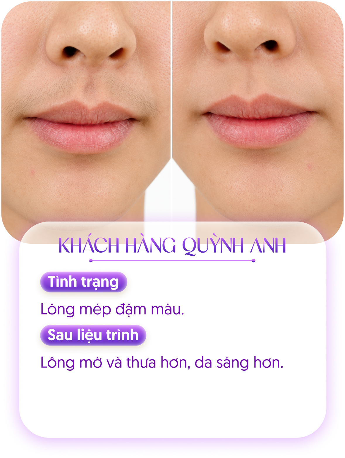 Kết quả khách hàng 1