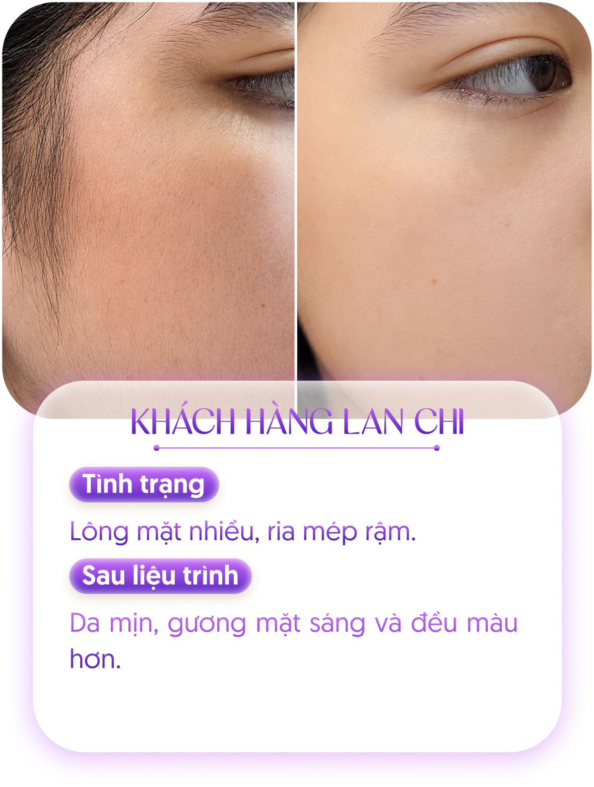 Kết quả khách hàng 2