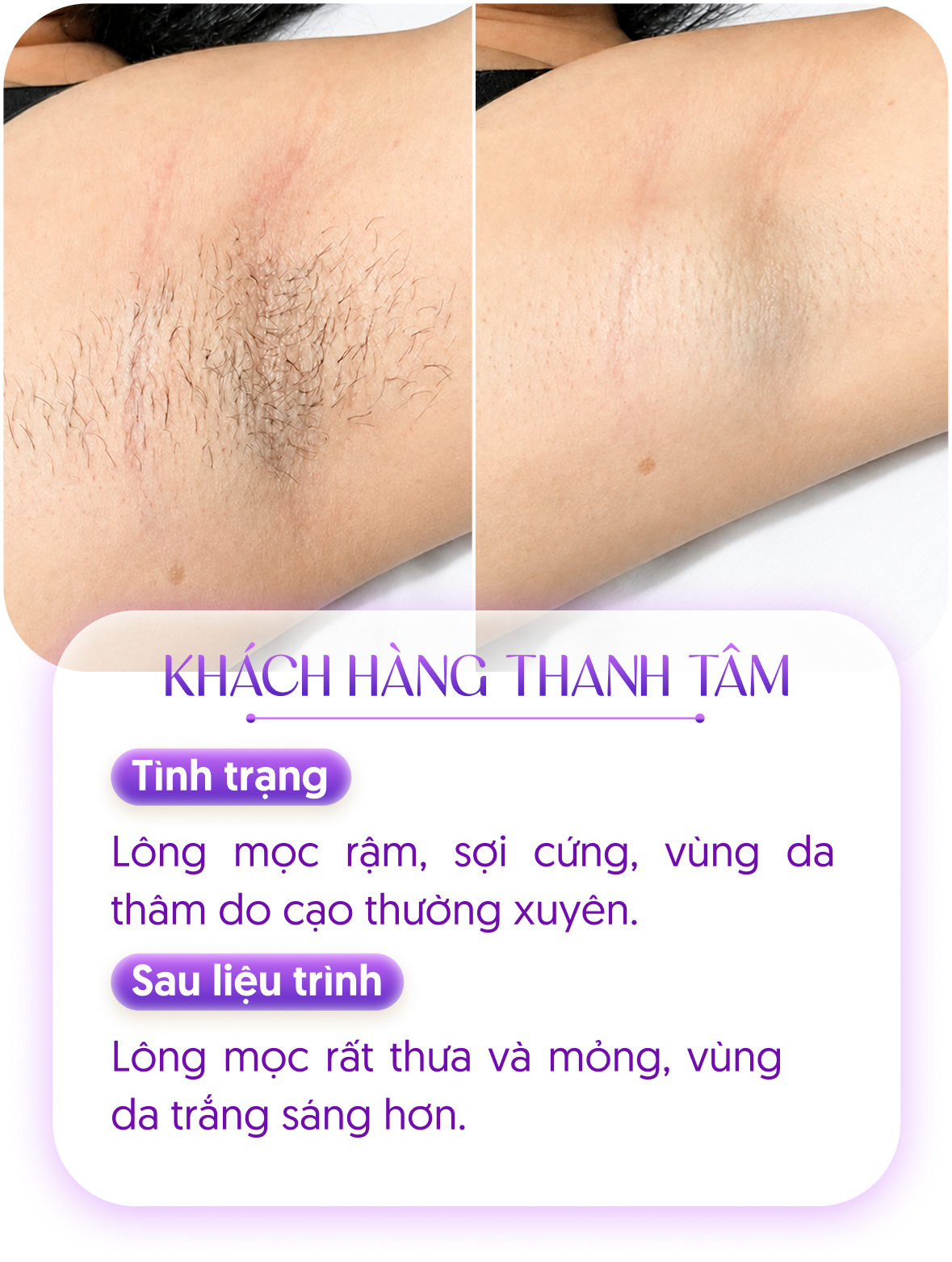 Kết quả khách hàng 3