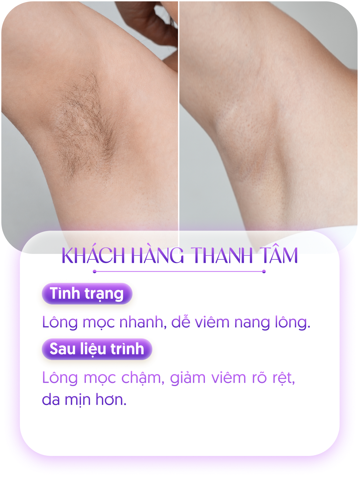 Kết quả khách hàng 2