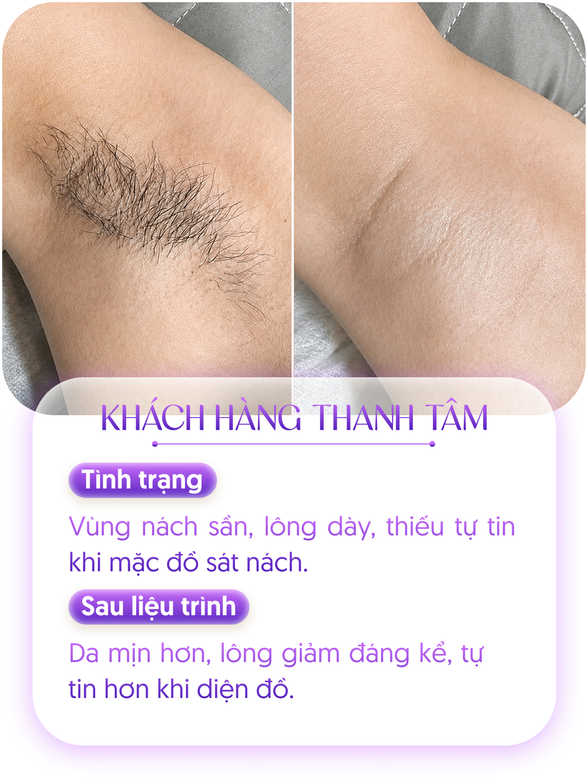 Kết quả khách hàng 1