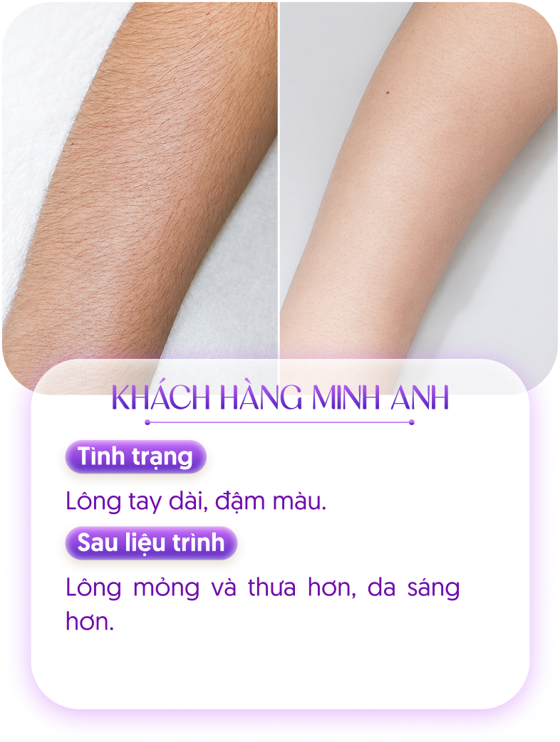 Kết quả khách hàng 1