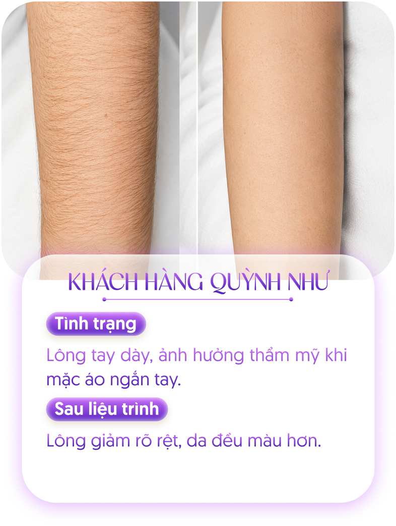 Kết quả khách hàng 3