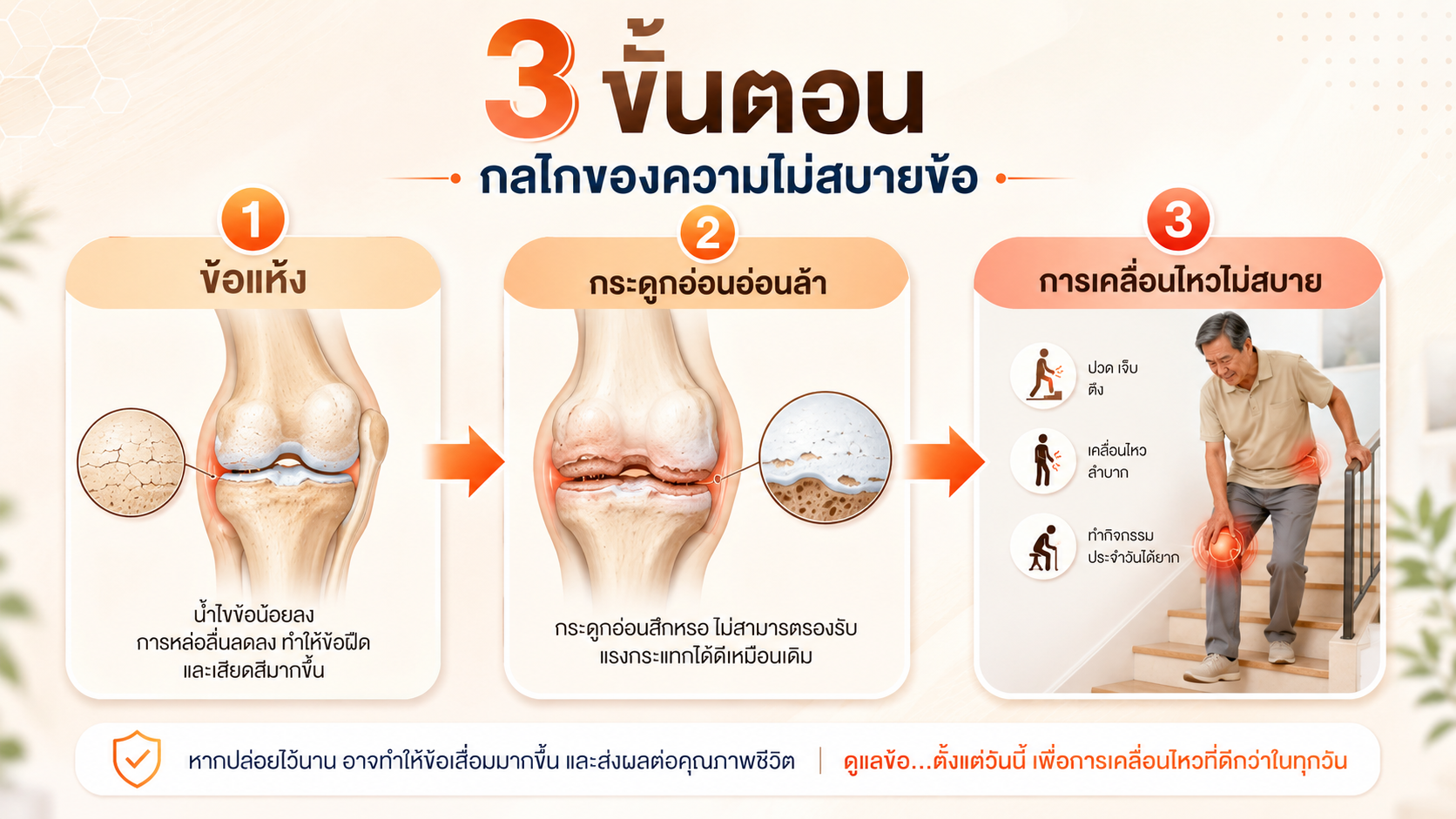 ภาพอินโฟกราฟิกภาษาไทย: ข้อแห้ง กระดูกอ่อนอ่อนล้า และการเคลื่อนไหวไม่สบาย