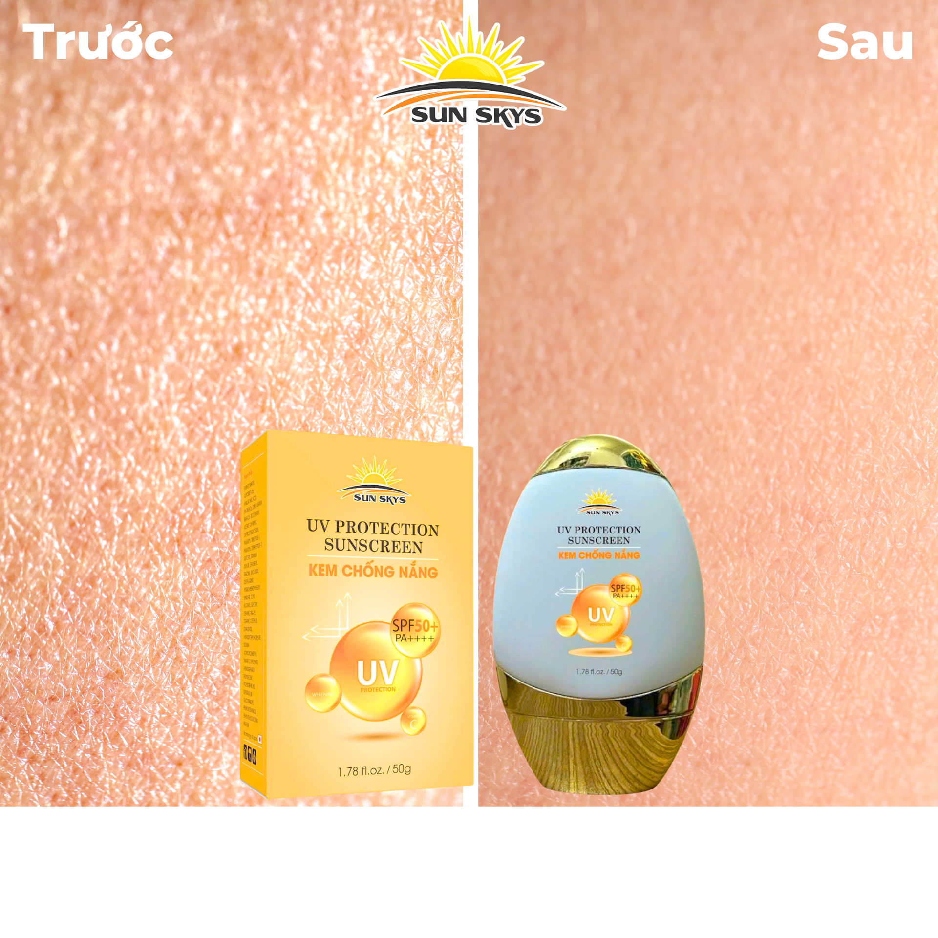 Trước và sau – da được cấp ẩm, mịn màng hơn