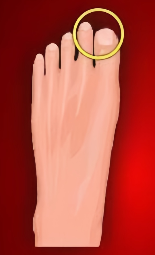 Foot B
