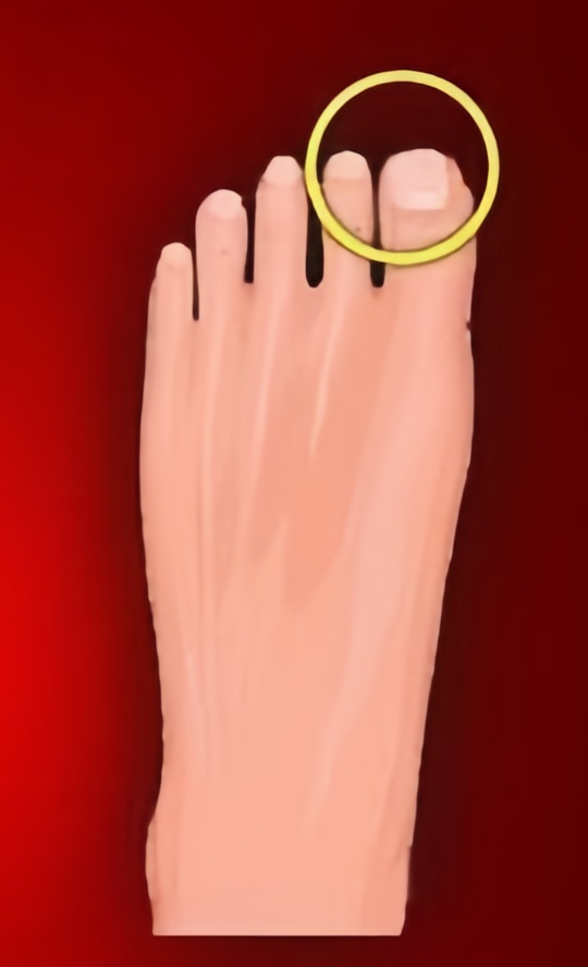 Foot C