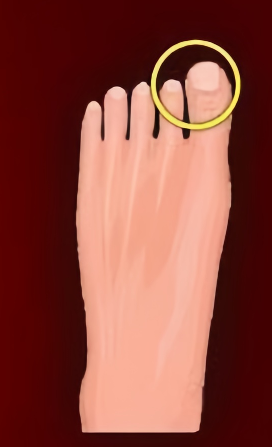 Foot D