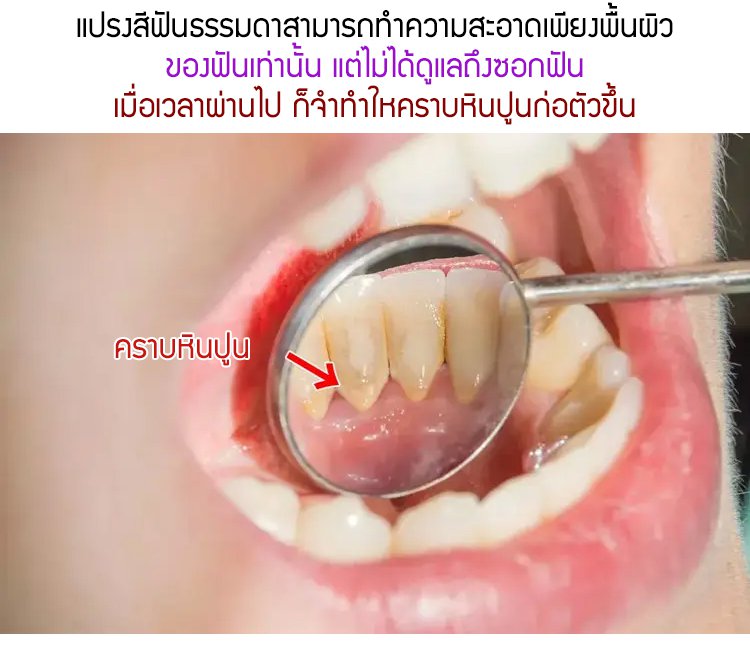 รายละเอียดสินค้า