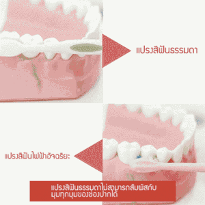 แปรงสีฟันโซนิคแบรนด์ X.Q.M.Q