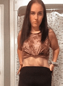 Woman showing loose skin