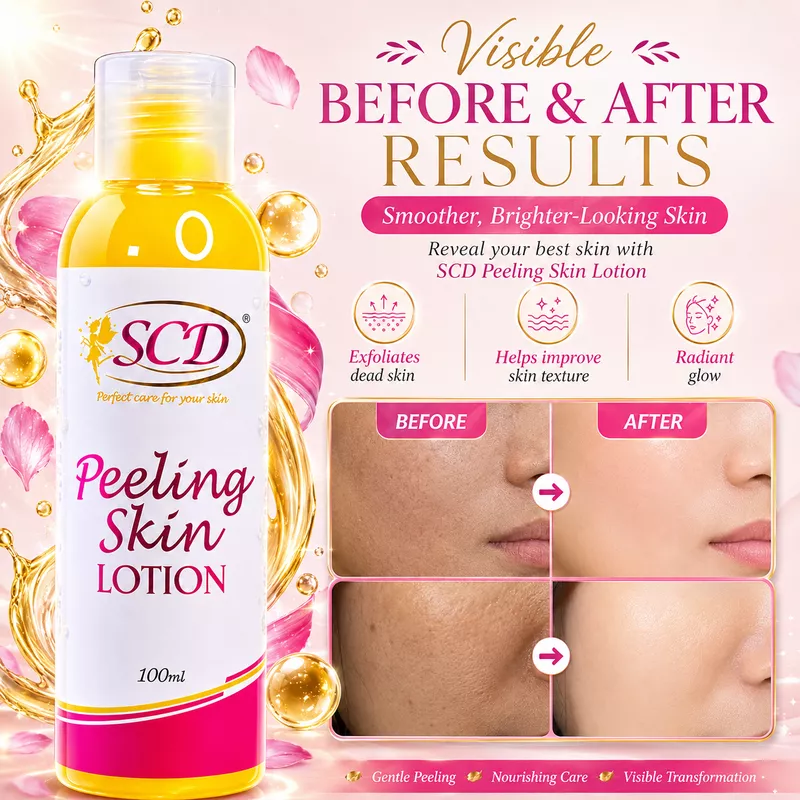 SCD Peeling Skin Lotion — results