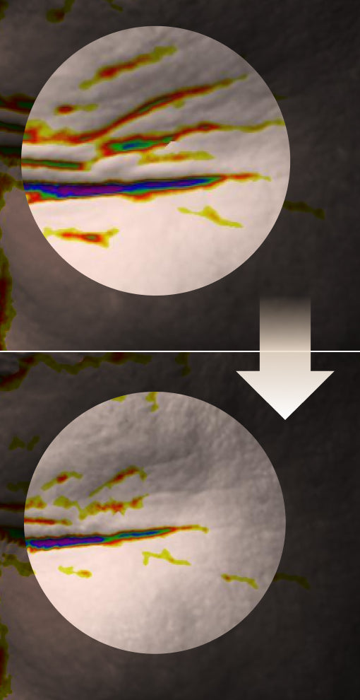 Before and after wrinkle depth comparison