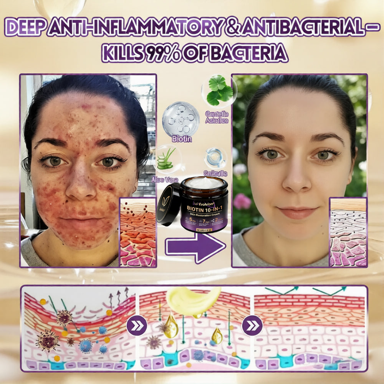 Acne breakouts skin