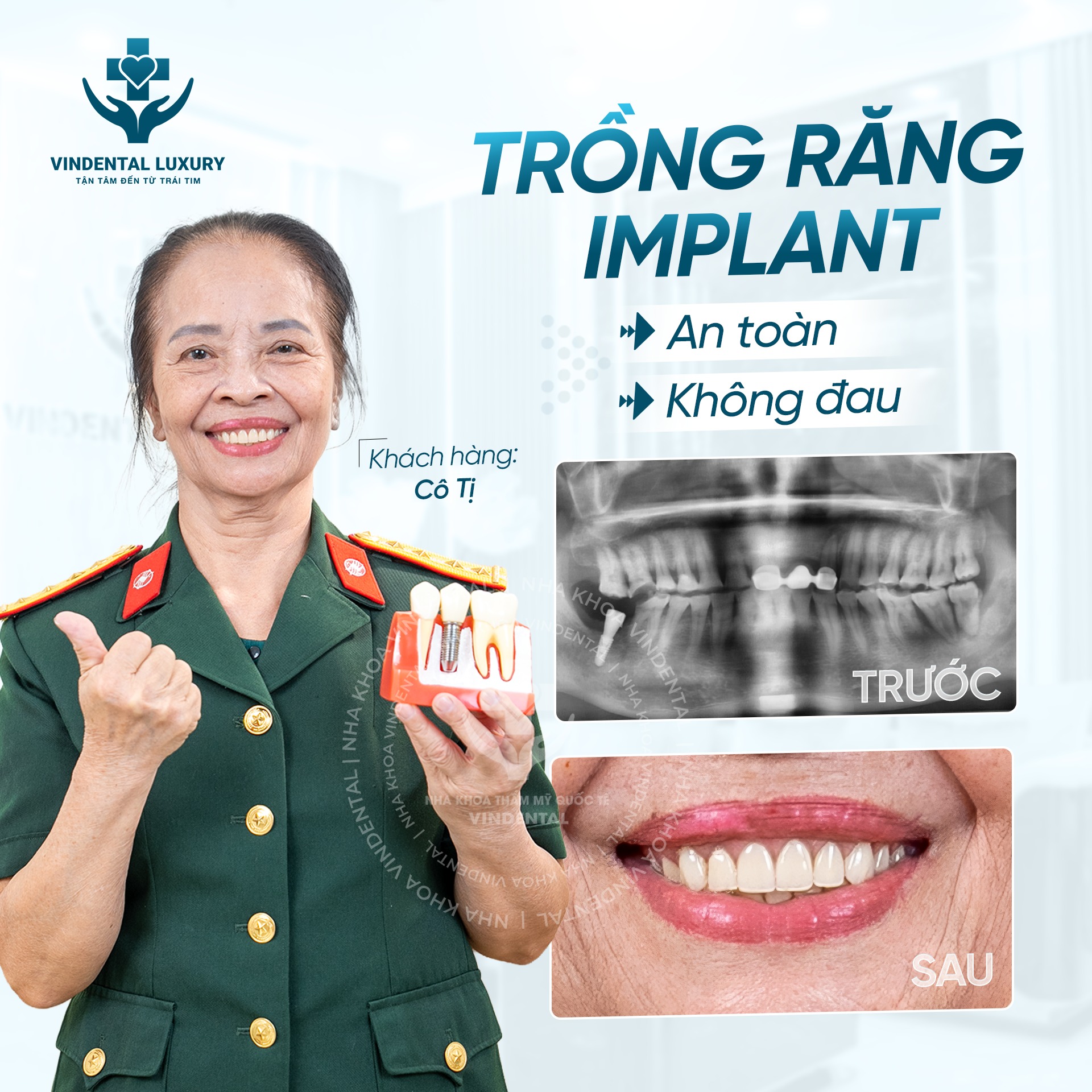 Feedback Implant - khách hàng Nguyễn Văn Công