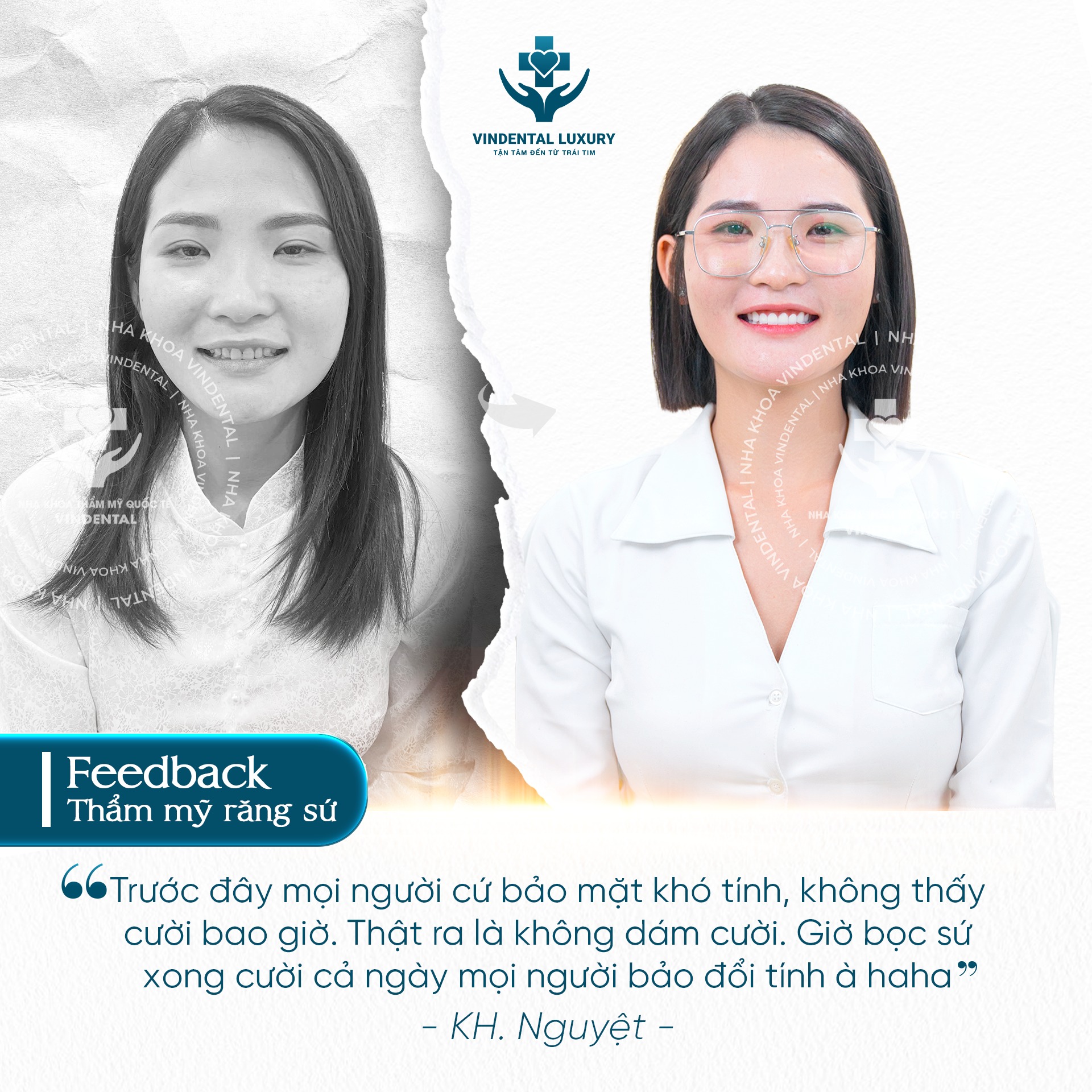 Feedback Implant - khách hàng Ngô Văn Nhu