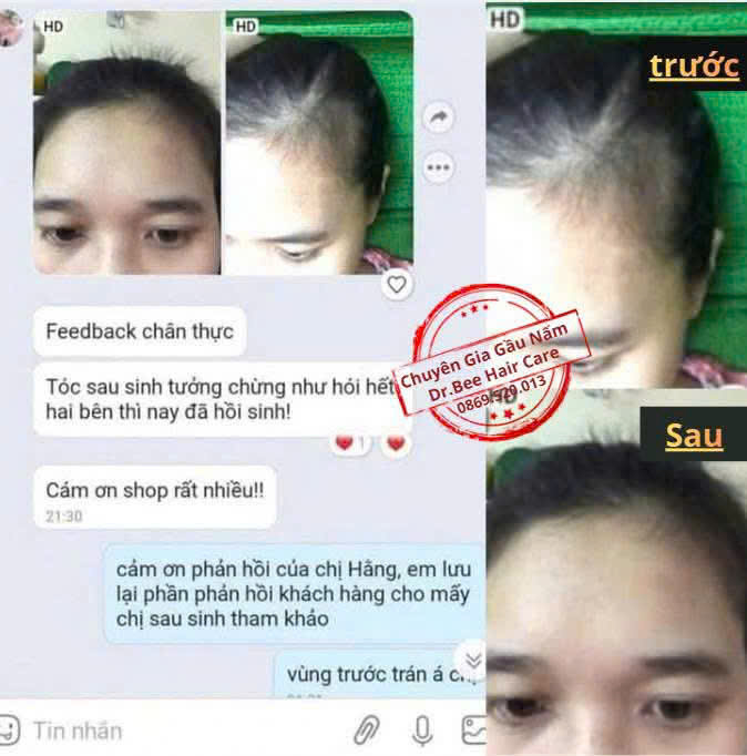 Feedback Mẹ sau sinh