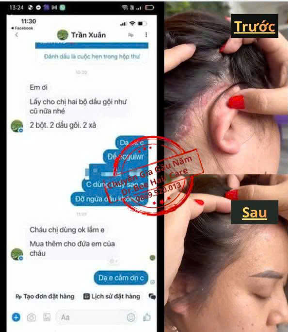 Feedback Nam giới trị nấm