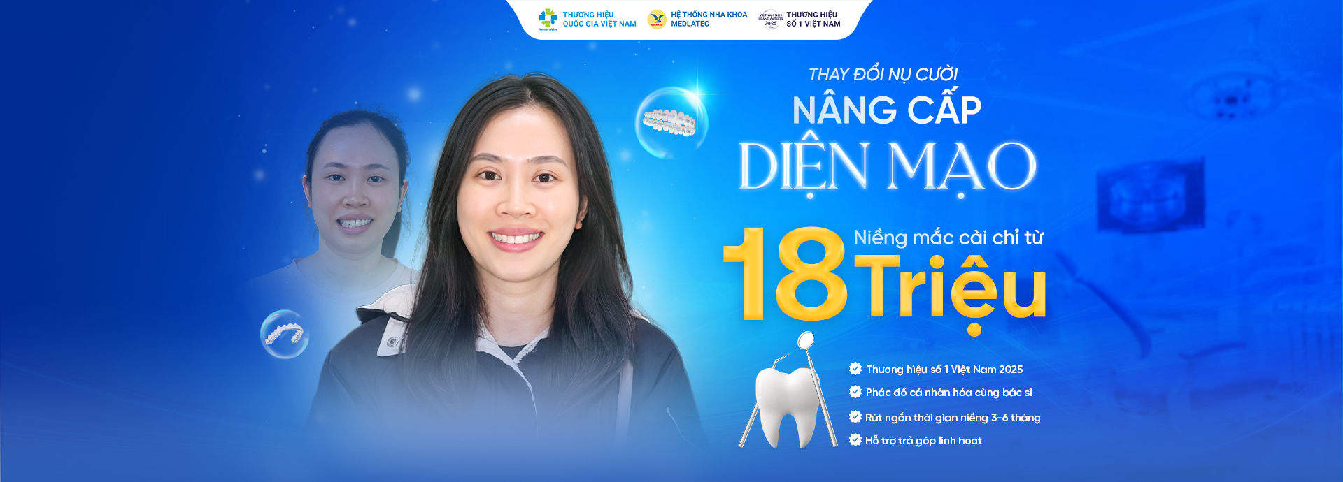Nâng cấp diện mạo – niềng mắc cài chỉ từ 18 triệu