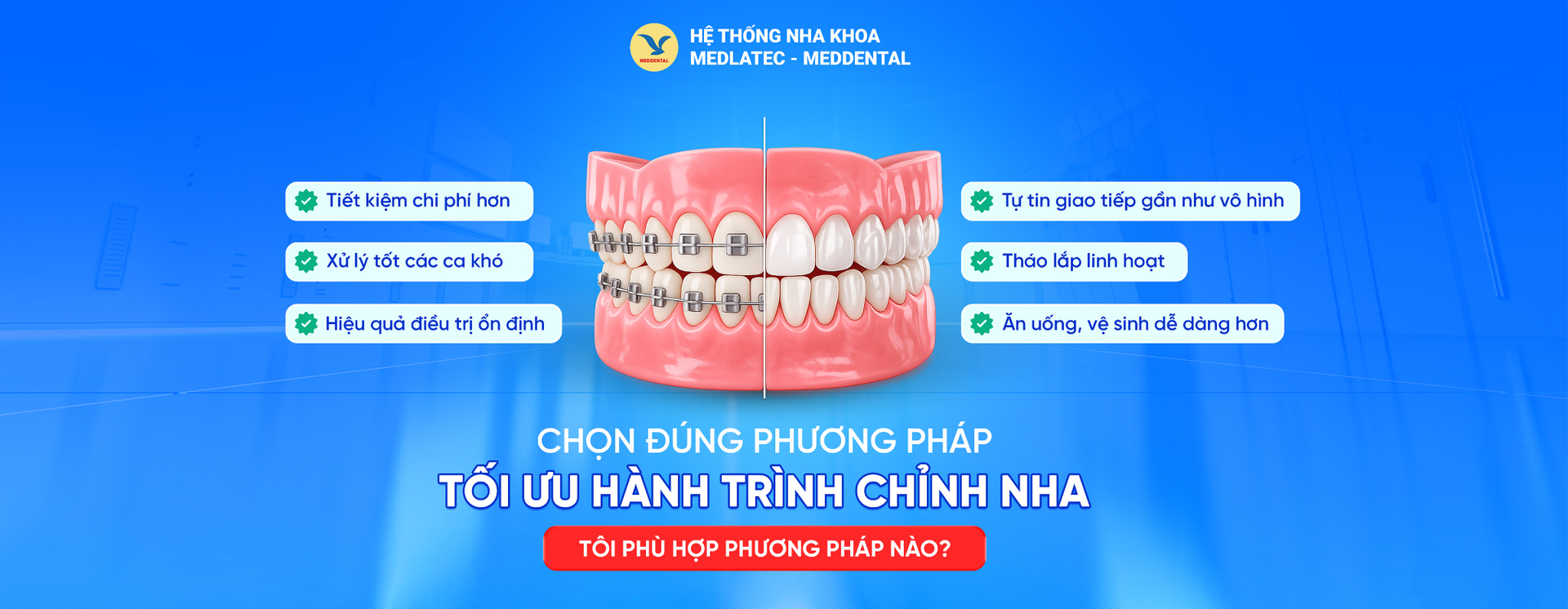 Chọn đúng phương pháp chỉnh nha