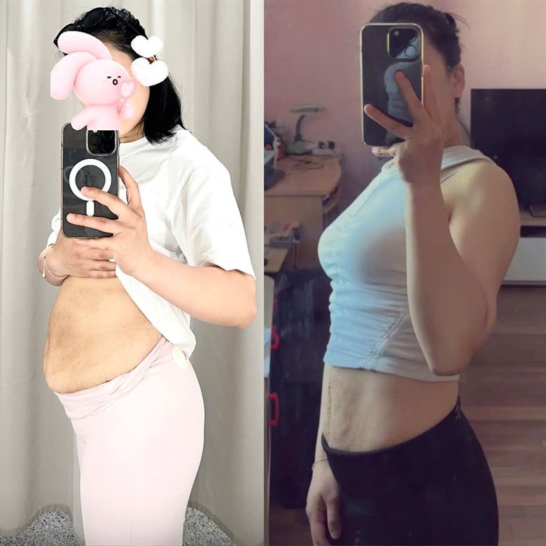 Chị Mai trước và sau