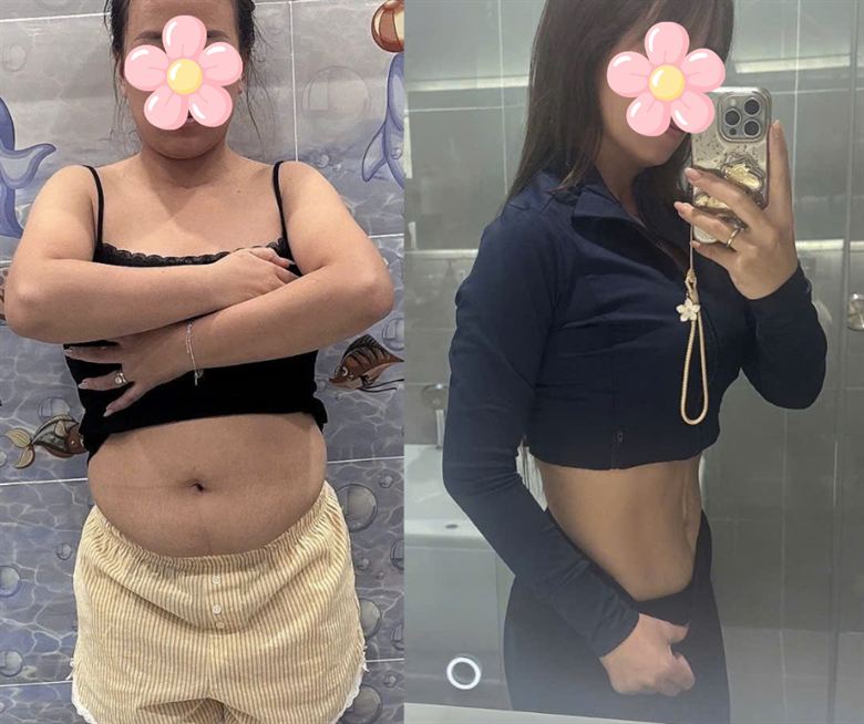 Chị Hằng trước và sau
