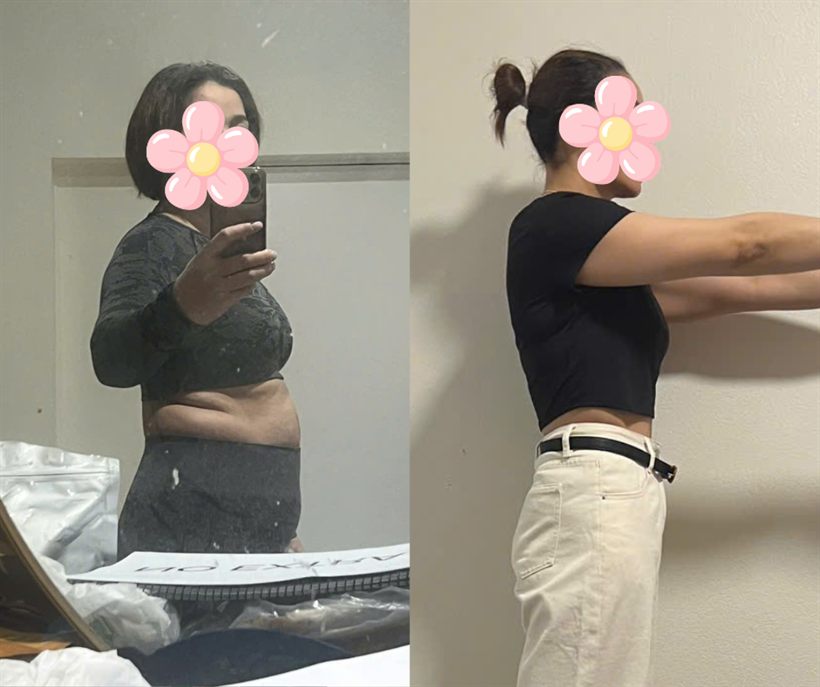 Chị Thủy trước và sau
