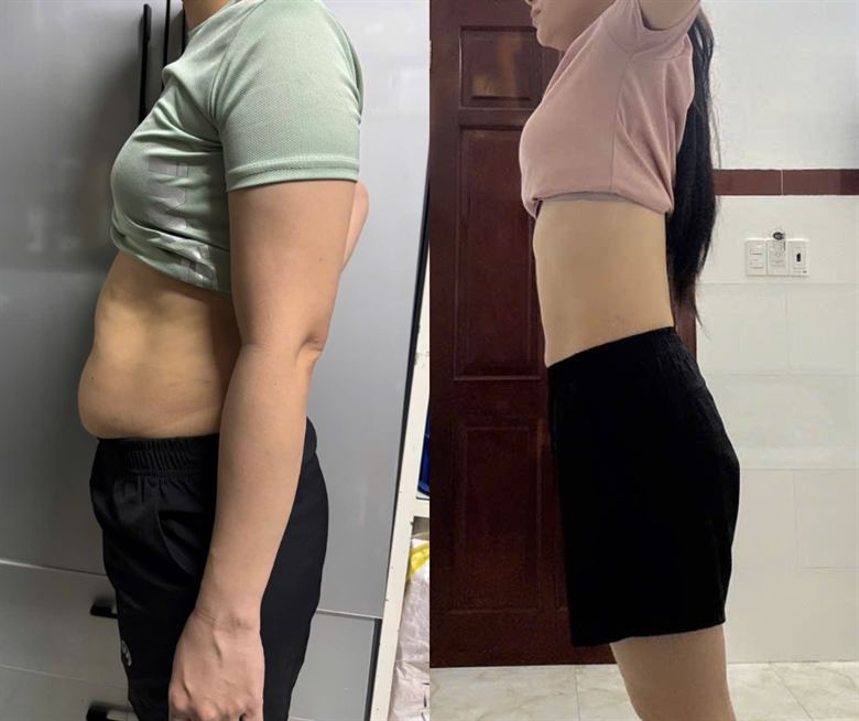 Chị Kim Cương trước và sau