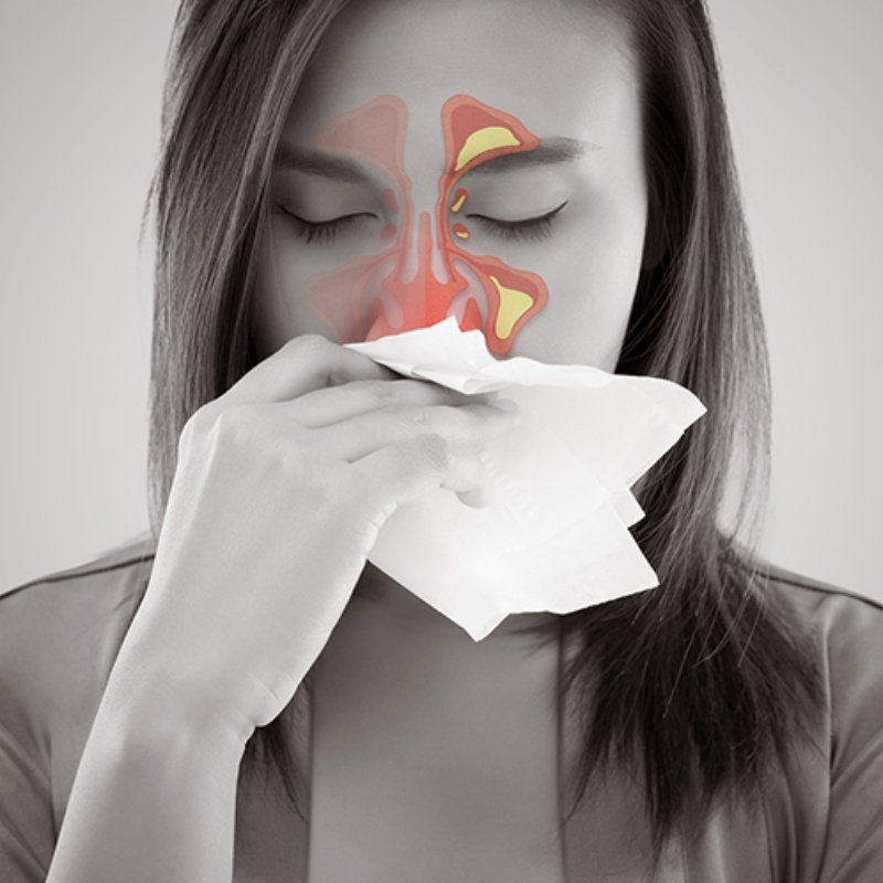 Vi&ecirc;m mũi dị ứng