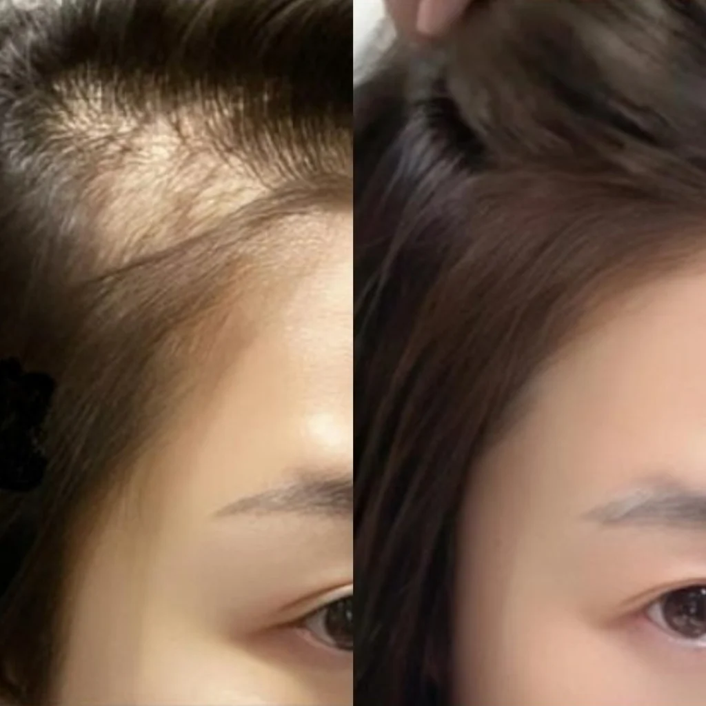 เจนิส