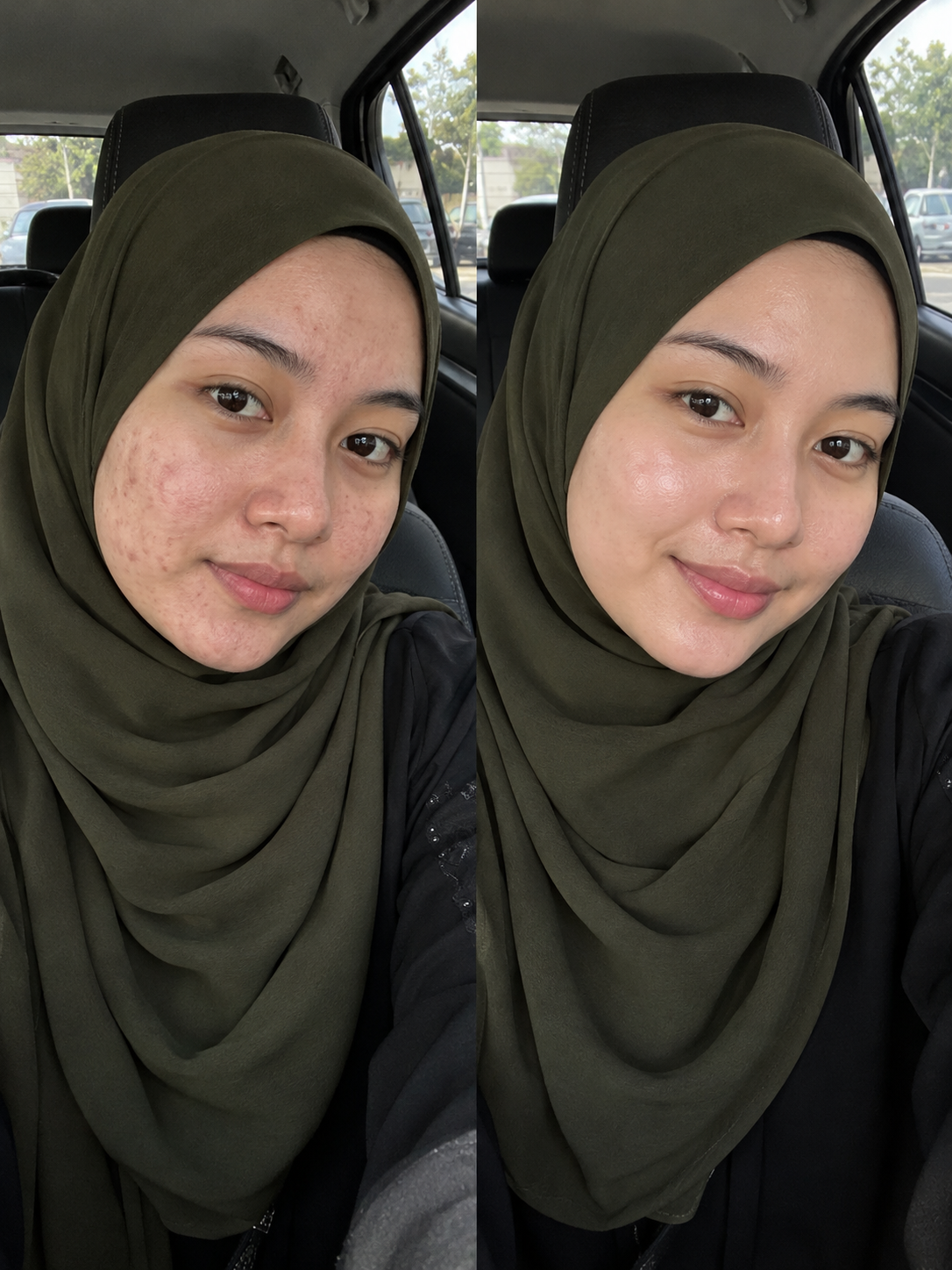Foto penjagaan kulit 3