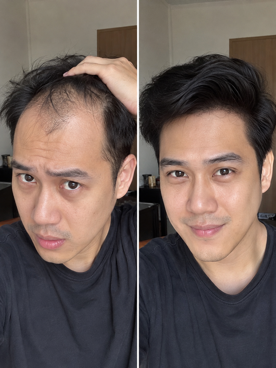 ผลลัพธ์การดูแลเส้นผม