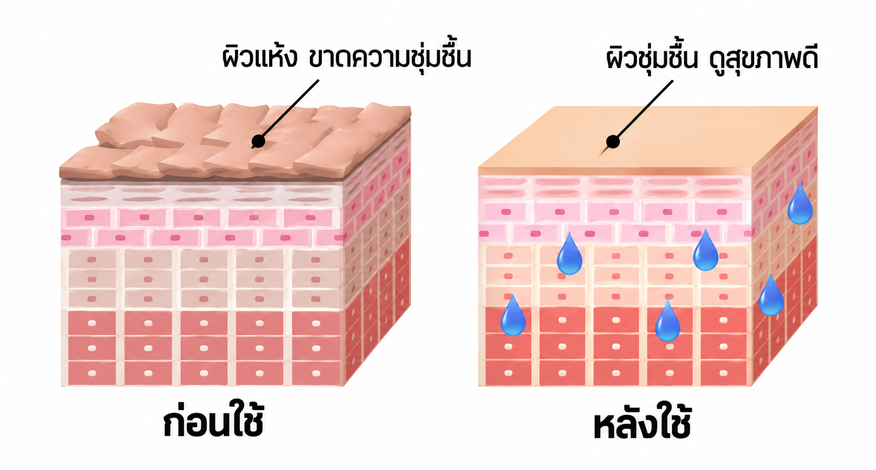 การเปลี่ยนแปลงผิวสัปดาห์ที่ 3