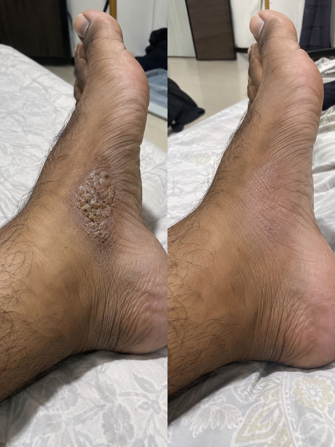 Gambar perbandingan sebelum dan selepas