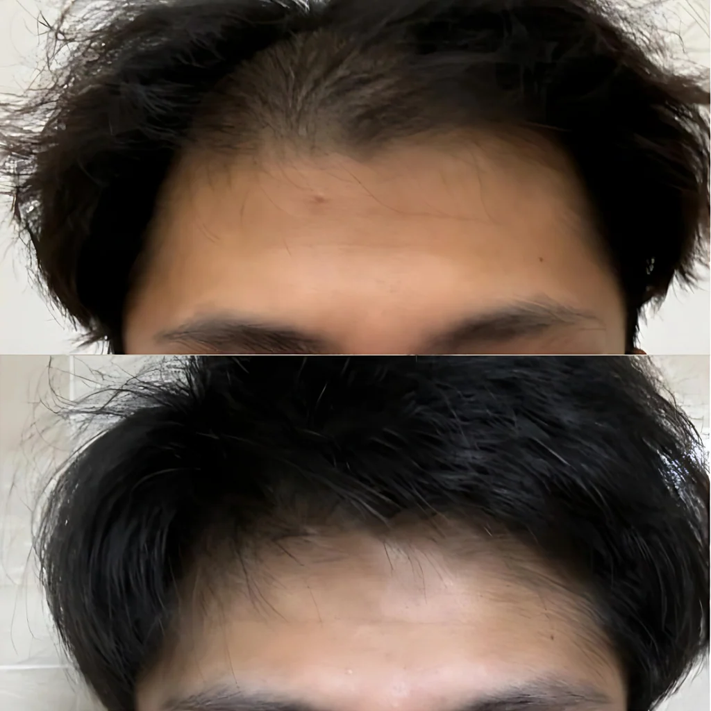 สตีเวน