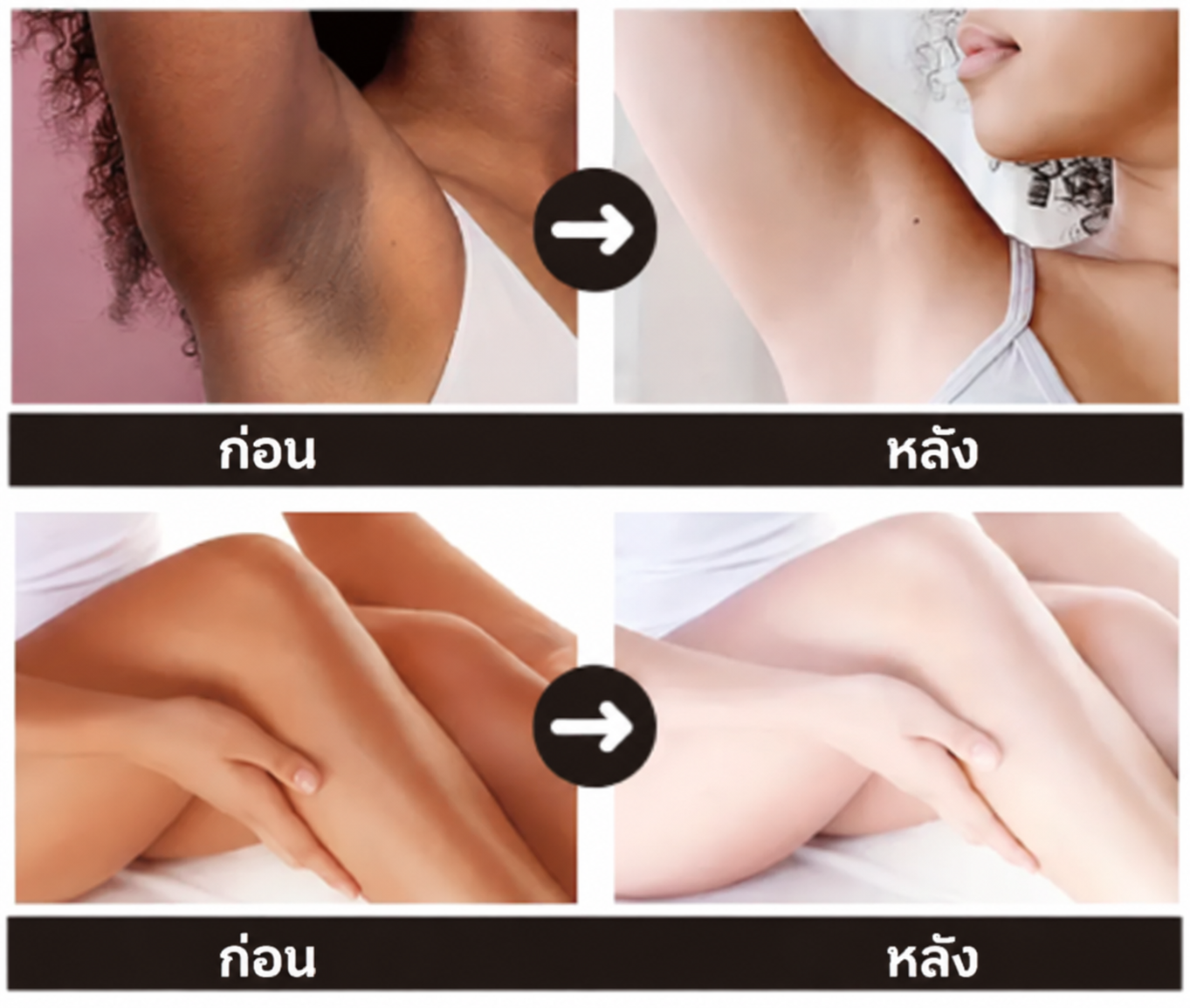 ผลลัพธ์การดูแลผิว