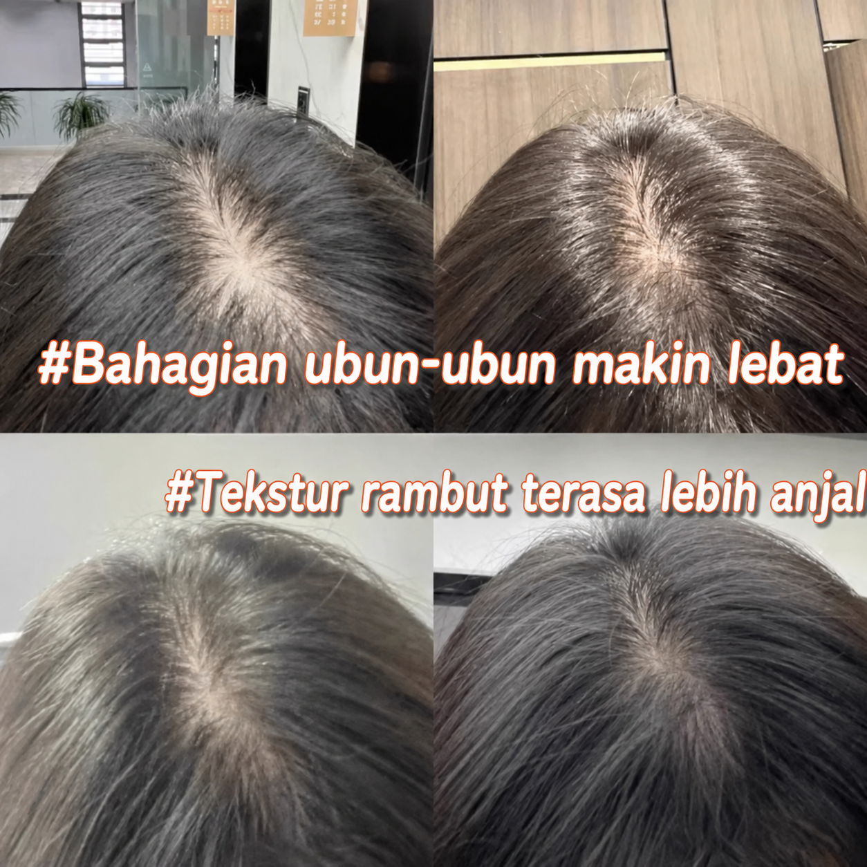 Baby hair growth