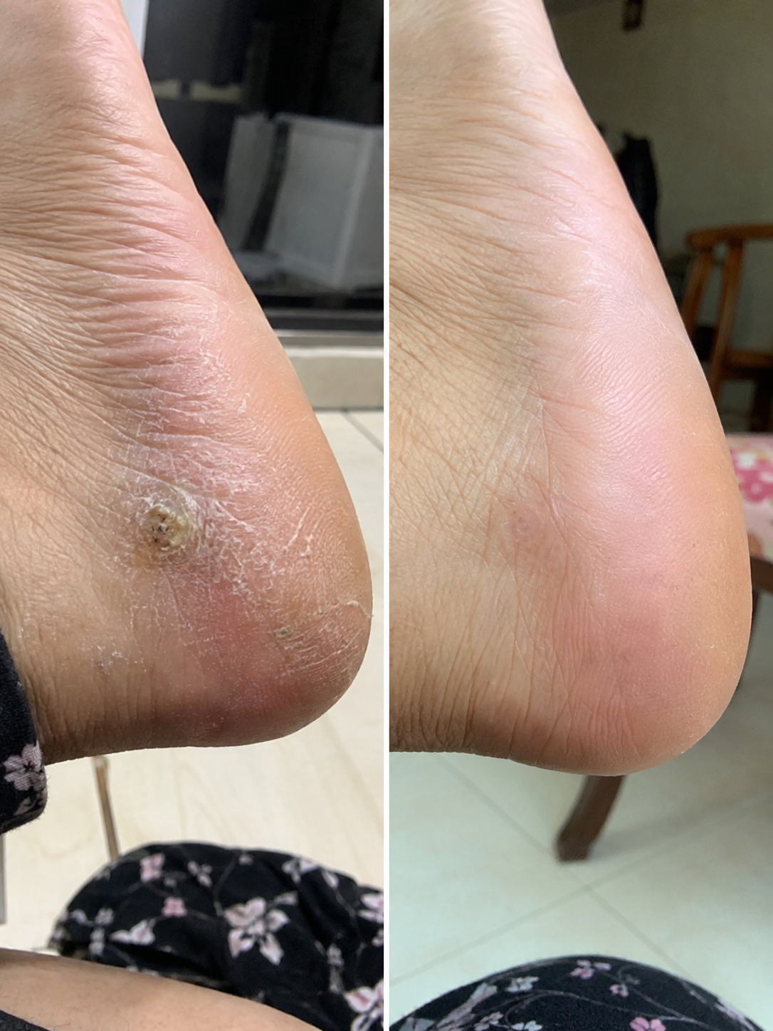 Hasil sebelum dan selepas pelanggan 2
