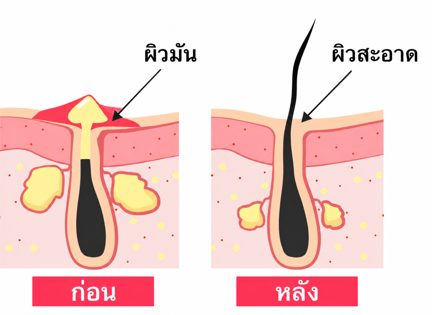 การทำความสะอาดผิว