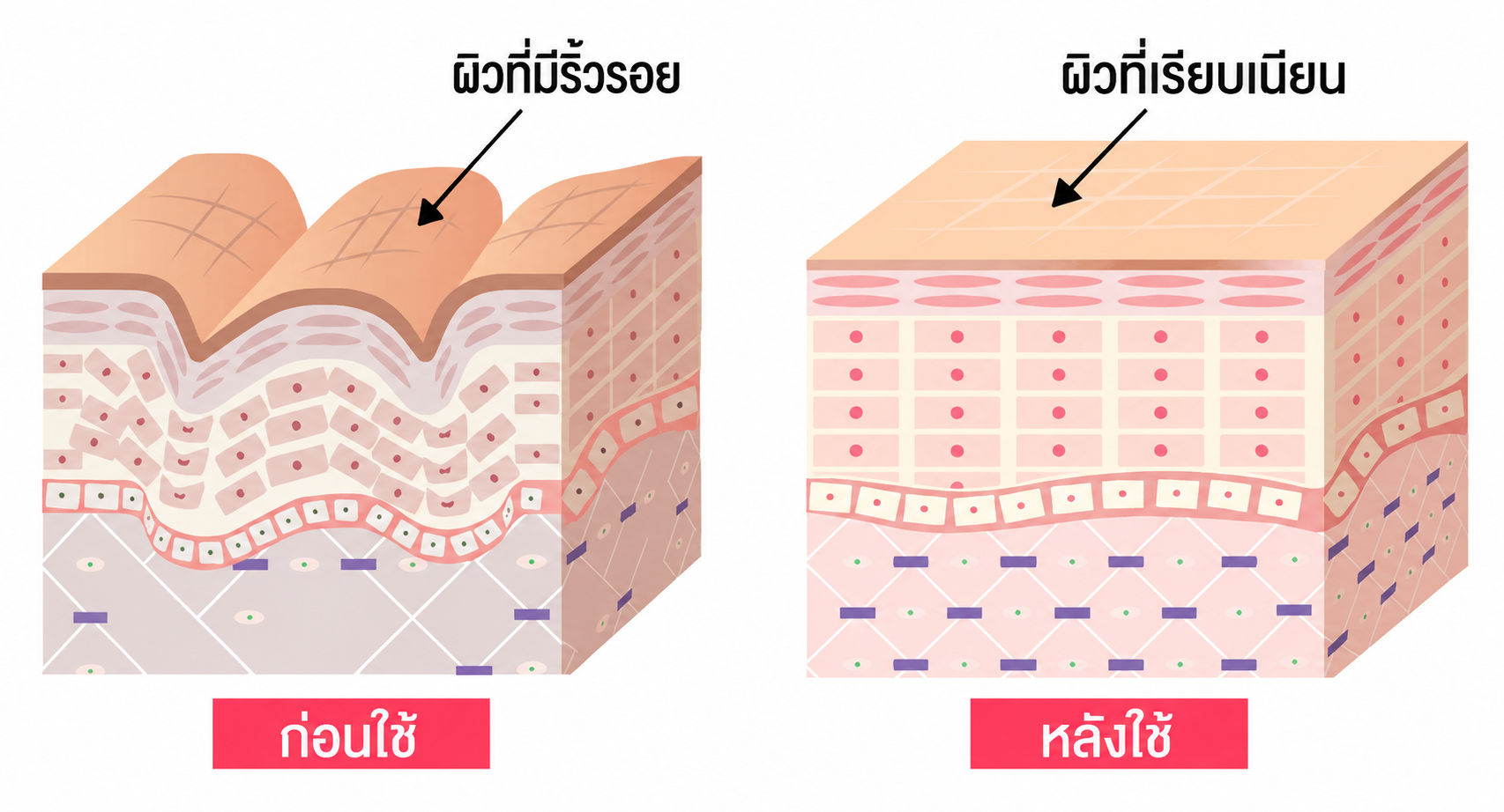 การเปลี่ยนแปลงผิวสัปดาห์ที่ 4