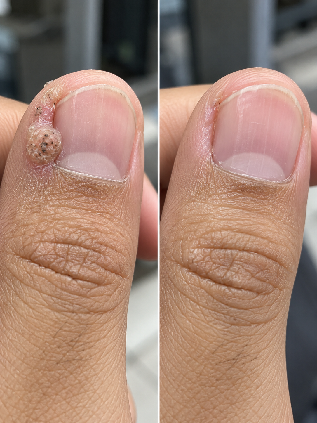 Hasil sebelum dan selepas pelanggan 1
