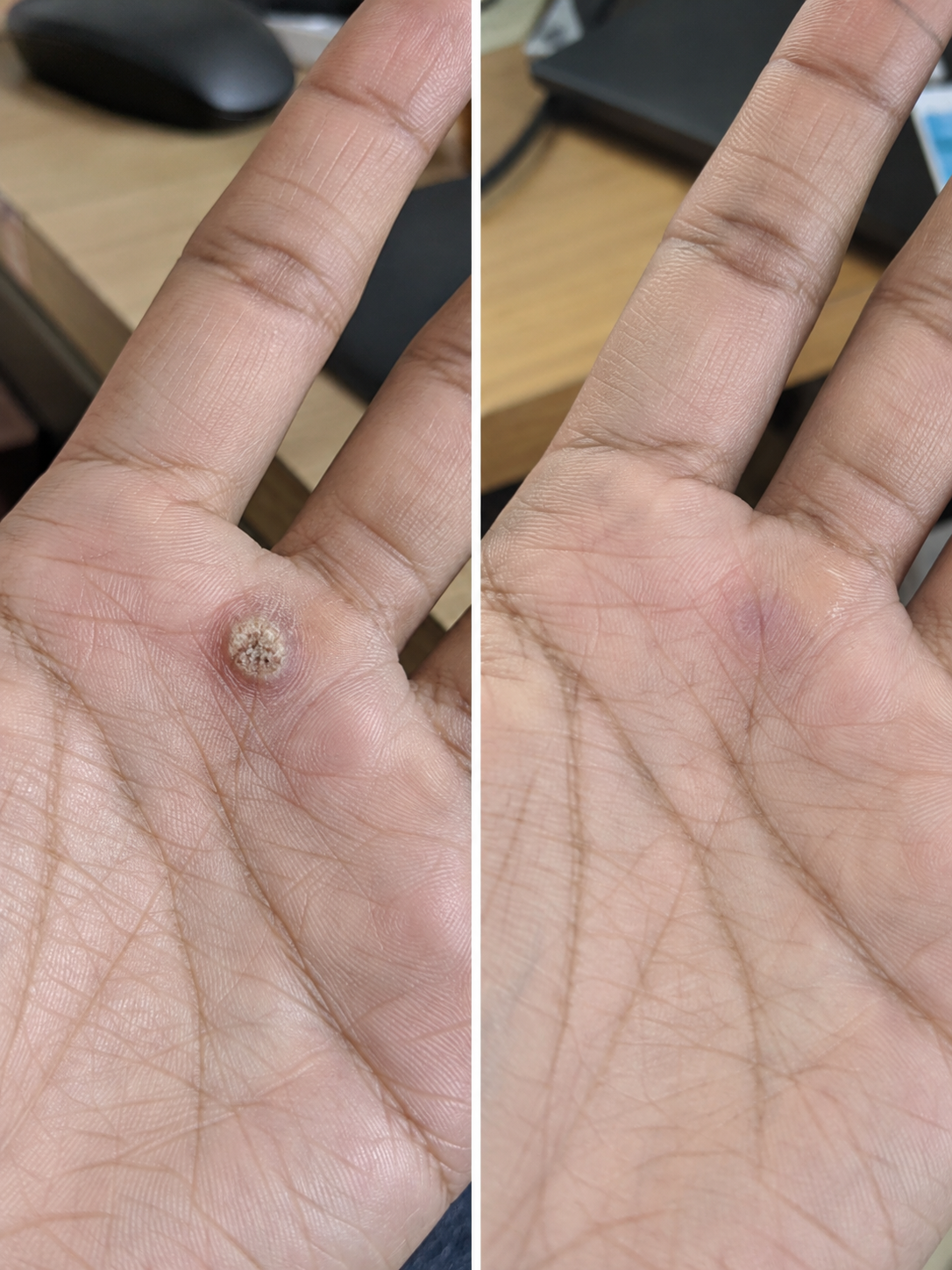 Gambar perbandingan kelima