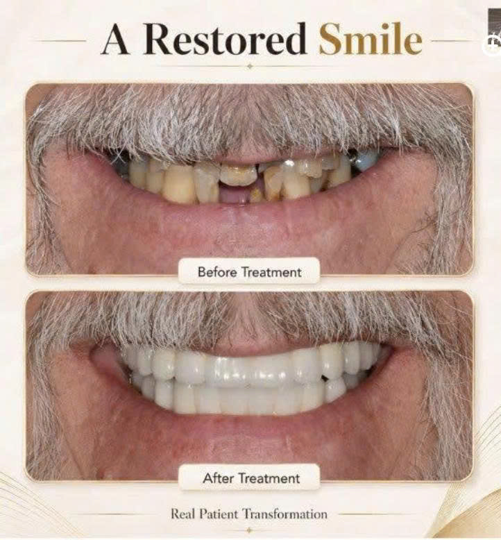 Case 4 Before and After