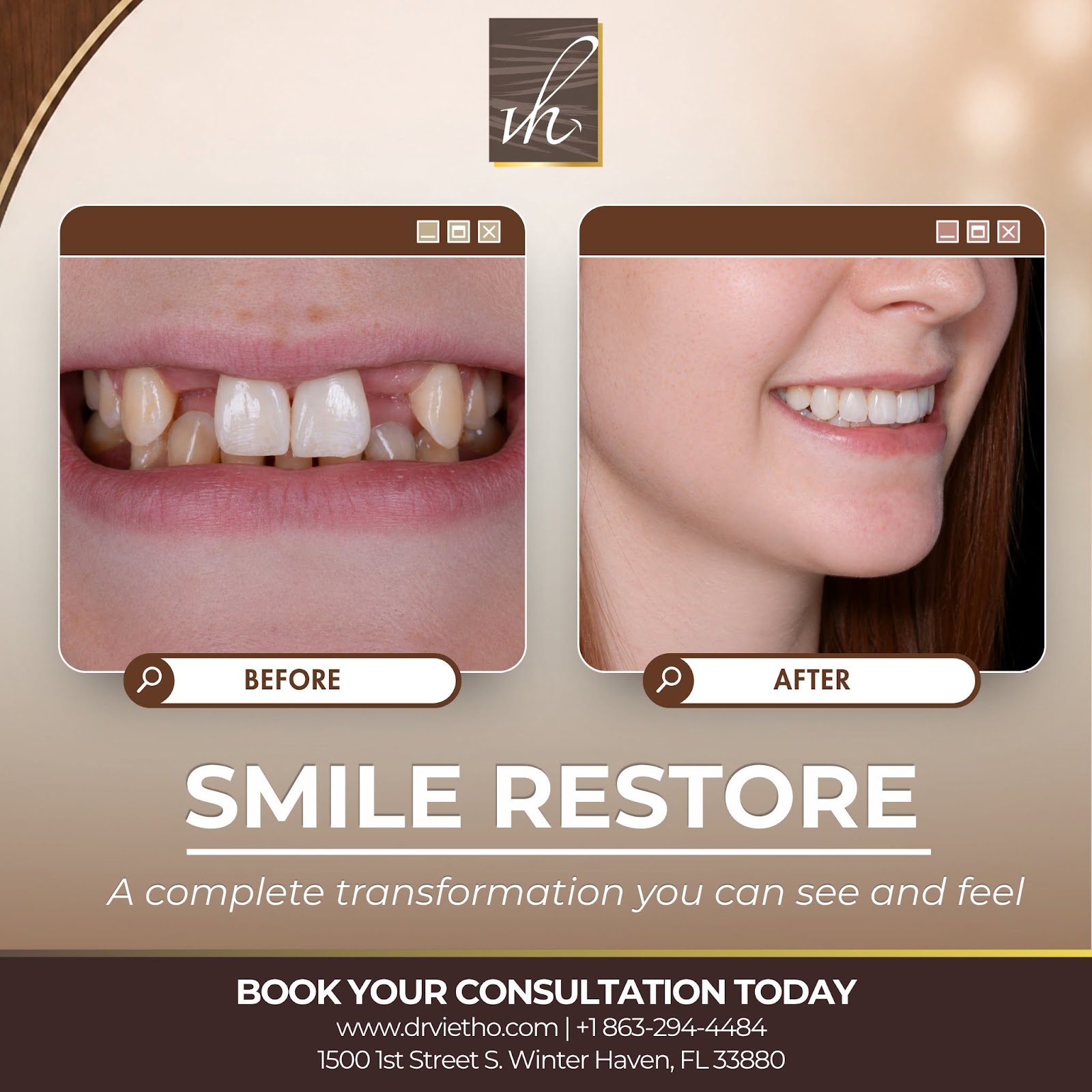 Case 1 Before and After